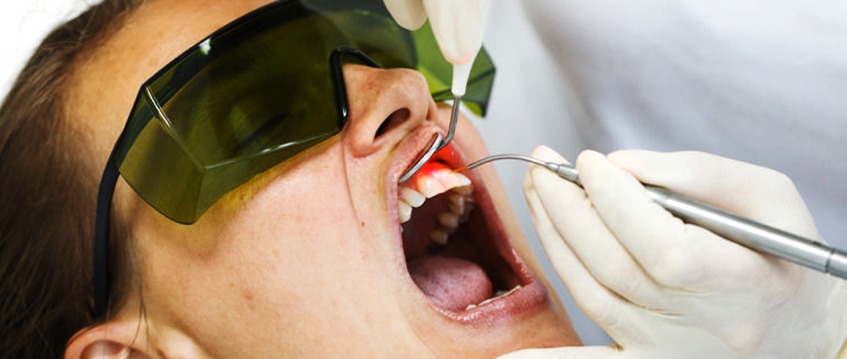 blogpost thmb dental laser treat