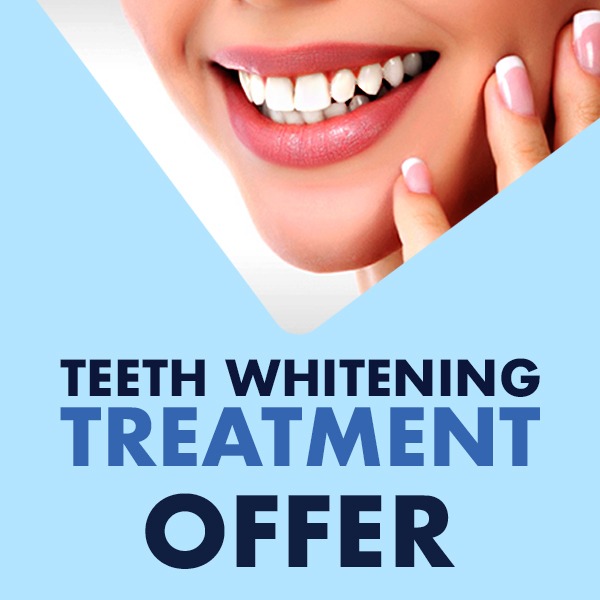 Teeth Whittening offer