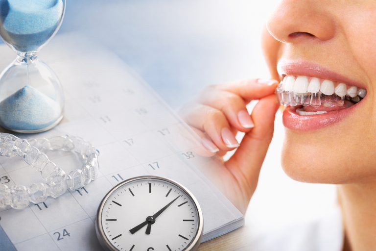 How Long Does It Take for Invisalign to Work? 